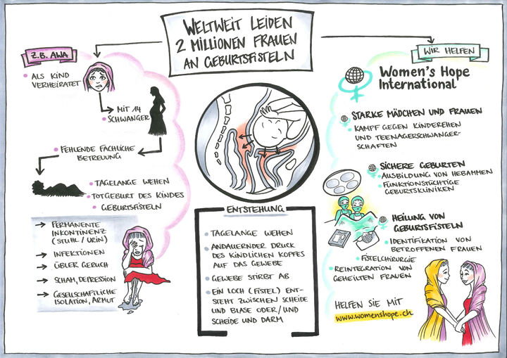 Geburtsfisteln Geburtsfisteln