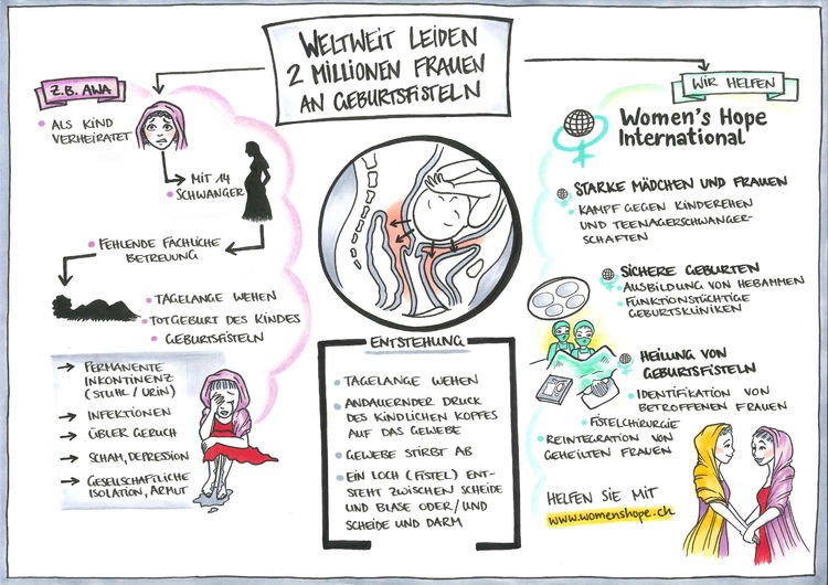 Geburtsfisteln Geburtsfisteln